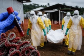 dsoden-ebola-uyarisi-kdcde-risk-cok-yuksek-106a88659d455d1.webp.webp