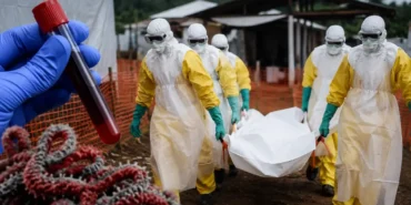 dsoden-ebola-uyarisi-kdcde-risk-cok-yuksek-106a88659d455d1.webp.webp